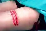 Man savagely tortured with knife cuts 2