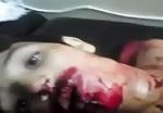 Man suffering from deep wounds 2