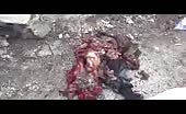 Mangled children in syria 12