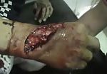 Severe hand cut in knife fight 2