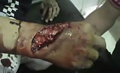 Severe hand cut in knife fight 7