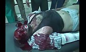 Severe wounded man taking last breaths 5