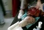 Severely wounded civilians 1