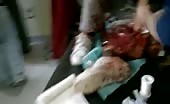 Severely wounded civilians 11