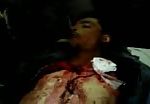Syrian bombing victim 1