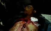 Syrian bombing victim 8