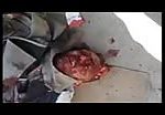 Corpse of a man with cracked skull 1