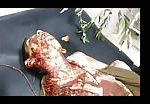Dismembered corpse of a syrian boy (graphic content) 2