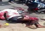 Legs crushed in motorbike accident 2