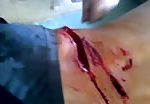 Man brutally wounded 1