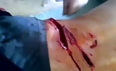 Man brutally wounded 12