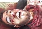 Man dead and face disfigured 1