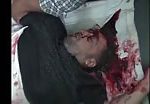 Man head cracked open in shelling 1