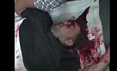 Man head cracked open in shelling 2