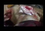 Treatment of fsa member wounded by bullet shots 3