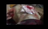Treatment of fsa member wounded by bullet shots 14