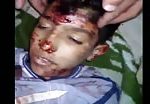 Young syrian boy, killed by shrapnel 2