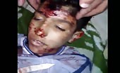 Young syrian boy, killed by shrapnel 15