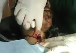 Lady with slit throat and object inside 2