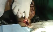 Lady with slit throat and object inside 11