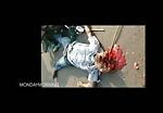 Man face squished in motorbike accident 2