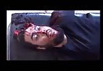 Man with head shot and skull cracked 1
