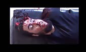 Man with head shot and skull cracked 11