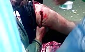 Syria war - a surgery in a field clinic 16