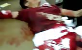 Wounded child gasping (graphic content) 6