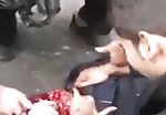 Civilian shot in the head by police 1