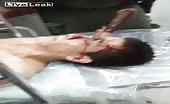 Shocking footage - wife stabs husband in the eye 5