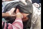 Syria - a wounded woman splinters in back 1