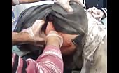 Syria - a wounded woman splinters in back 7