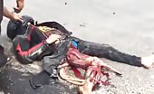 Biker hits trailer and gets leg ripped 3