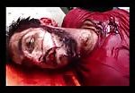 Corpse of syrian civilian 2