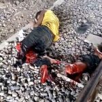 Indonesian man's leg amputated in by train 2