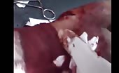 Metal fragment extraction from wrist 13