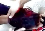 Syrian child shot in the head (graphic content) 3