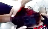 Syrian child shot in the head (graphic content) 15