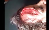Nasty wound on forehead 7