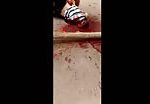 Bloody mess after being shot in head 2