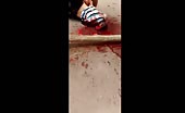 Bloody mess after being shot in head 1