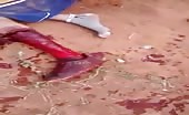 Dominican man leg brutally hacked with machete 13