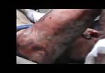Badly wounded man agonizing in pain. 1