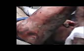 Badly wounded man agonizing in pain. 4