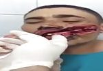 Guy gets his mouth slashed 1