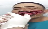 Guy gets his mouth slashed 10