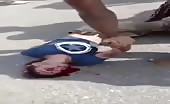 Motorcyclist hits car and gets head distorted 5