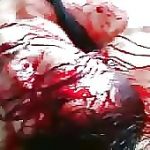 Bloodied dead body of syrian guy 5