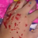 Girl tortures herself by injuring her hand with pieces of broken mirror 2